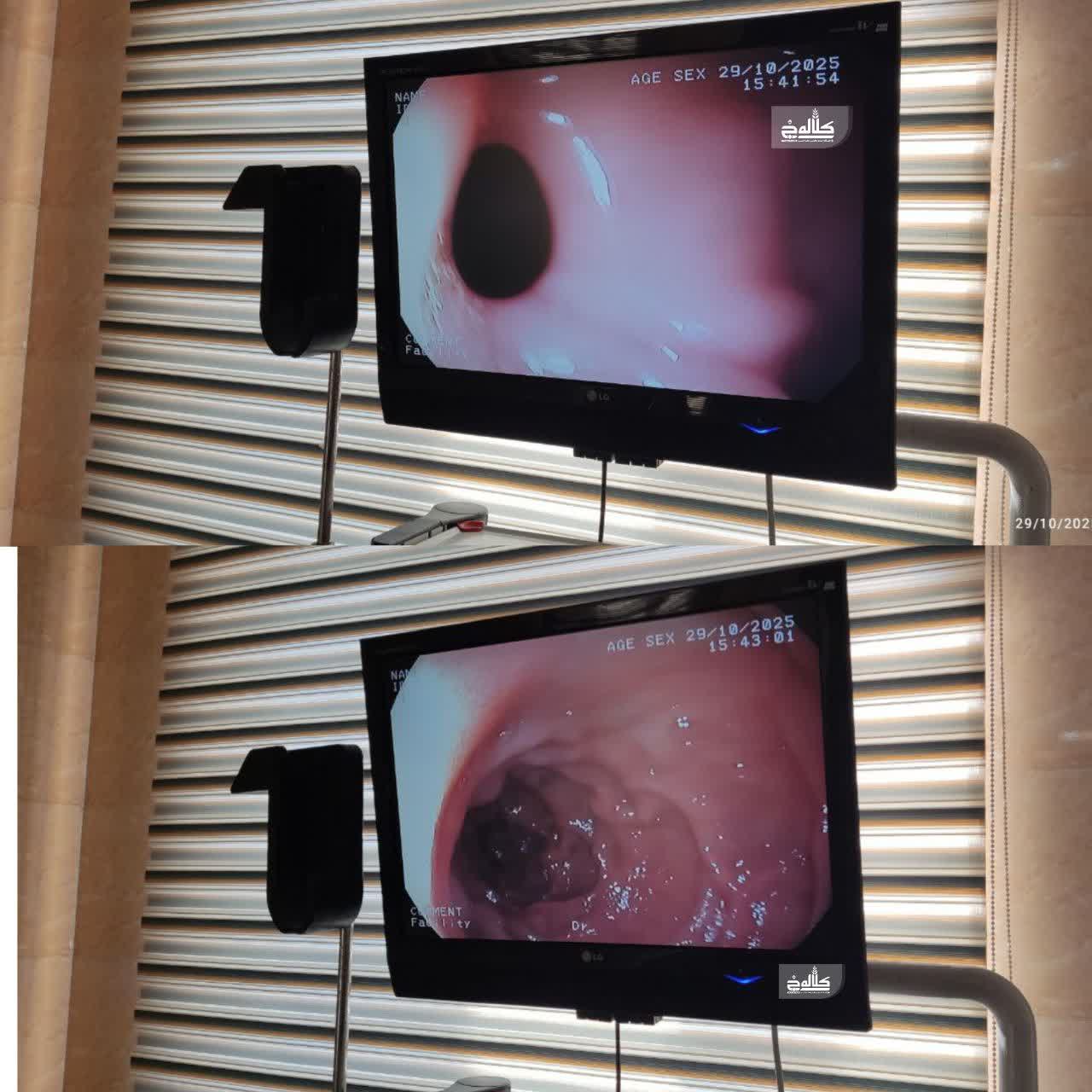 راه‌اندازی مجدد واحد اندوسکوپی بیمارستان حضرت رسول اکرم (ص) پس از ۶ سال توقف
